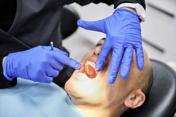 Best Knocked-Out Tooth (Avulsed Tooth) Treatment in Phoenix, AZ